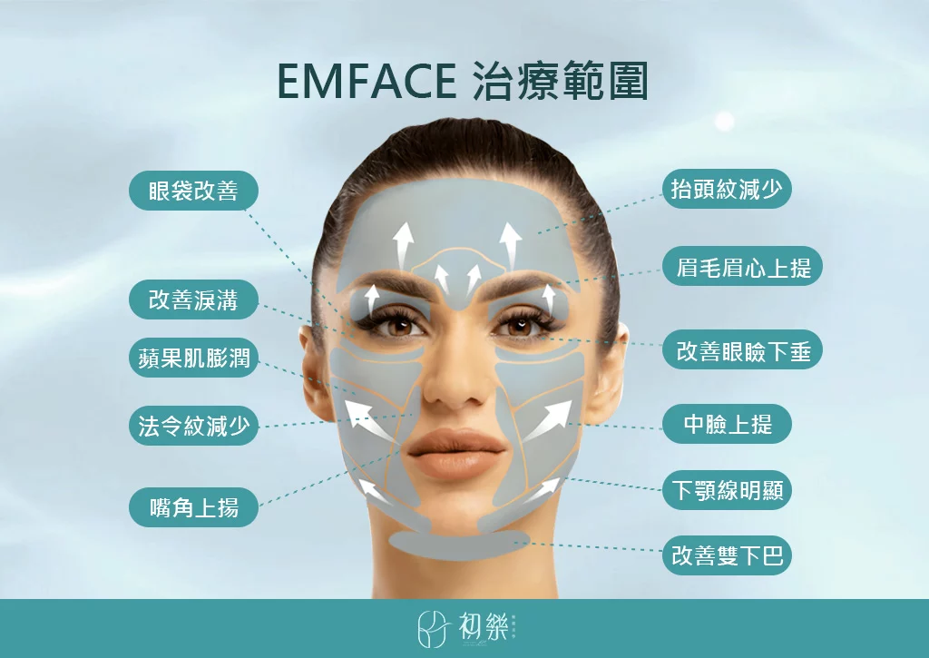不動刀醫美臉部拉提